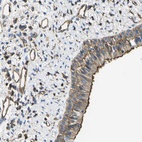 Anti-FAM110D Antibody