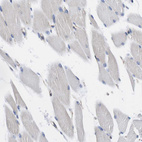 Immunohistochemical staining of human skeletal muscle shows no positivity in myocytes as expected.