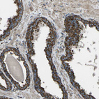 Anti-KLHL5 Antibody