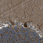 Immunohistochemical staining of human cerebellum shows moderate to strong granular cytoplasmic positivity in Purkinje cells.