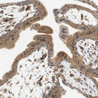 Anti-CYTH3 Antibody