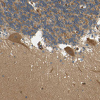 Immunohistochemical staining of human cerebellum shows strong cytoplasmic positivity in Purkinje cells.