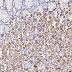 Anti-DPCR1 Antibody