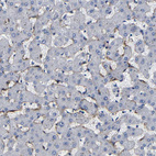 Immunohistochemical staining of human liver shows moderate membranous positivity in hepatocytes.