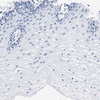 Immunohistochemical staining of human cervix shows no positivity in squamous epithelial cells as expected.