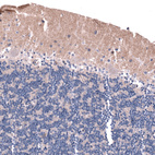 Anti-LRRC55 Antibody