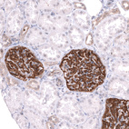 Anti-LRRC55 Antibody