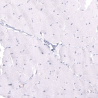 Anti-LRRC55 Antibody