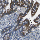 Immunohistochemical staining of human colon shows moderate cytoplasmic granular positivity in glandular cells.