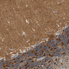 Anti-GDAP1 Antibody