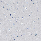 Anti-FDCSP Antibody