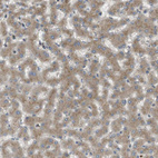 Anti-CLRN3 Antibody