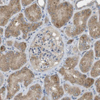 Anti-CLRN3 Antibody