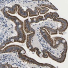 Anti-TMEM223 Antibody