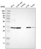 Western blot analysis in human cell line RT-4, human cell line U-251 MG, human kidney tissue, human liver tissue and human tonsil tissue.