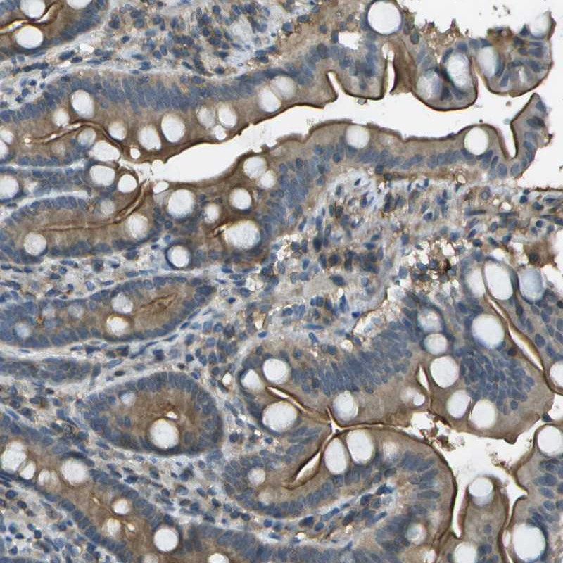 Anti-LRRC66 Antibody