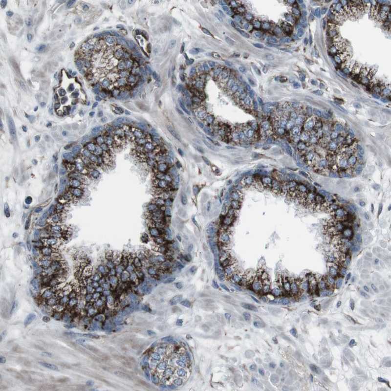 Anti-TMEM141 Antibody