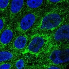 Anti-TMEM141 Antibody