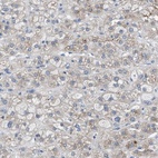 Anti-UAP1 Antibody