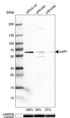 Anti-UAP1 Antibody