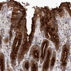 Anti-MLPH Antibody