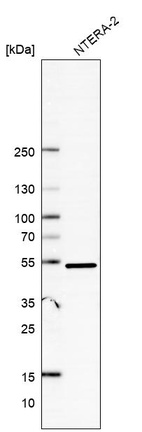 Anti-DDX47 Antibody