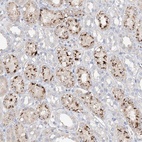 Anti-TRIM47 Antibody