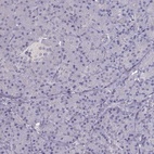 Immunohistochemical staining of human pancreas shows low expression as expected.