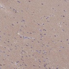 Immunohistochemical staining of human cerebral cortex shows high expression.