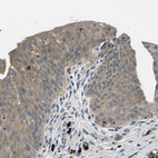 Anti-PLCE1 Antibody