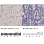 Anti-KIAA0319 Antibody