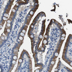 Anti-TMPRSS15 Antibody