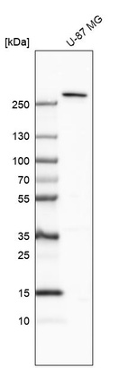 Anti-TMPRSS15 Antibody