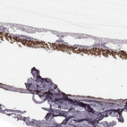 Anti-RCVRN Antibody