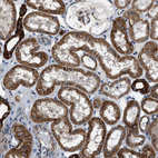 Anti-PCLO Antibody