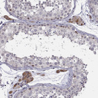 Anti-CHST8 Antibody