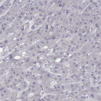 Anti-CHST8 Antibody