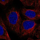 Anti-TNXB Antibody