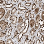 Anti-TLK1 Antibody