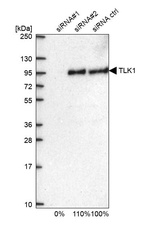 Anti-TLK1 Antibody