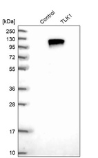 Anti-TLK1 Antibody