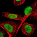 Anti-TLK1 Antibody