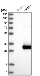 Anti-CABP7 Antibody