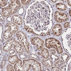 Anti-WNK4 Antibody