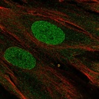 Anti-PHF11 Antibody