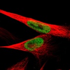 Anti-KDM3B Antibody