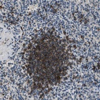 Anti-SALL3 Antibody