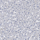 Anti-XIRP1 Antibody