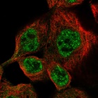 Immunofluorescent staining of human cell line A-431 shows localization to nucleoplasm.