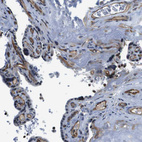 Anti-ESYT1 Antibody